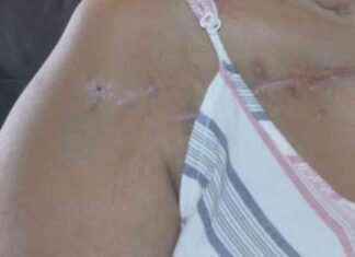 Testimonio de mujer sobreviviente de ataque de expareja testimonio-de-mujer-sobreviviente-de-ataque-de-expareja