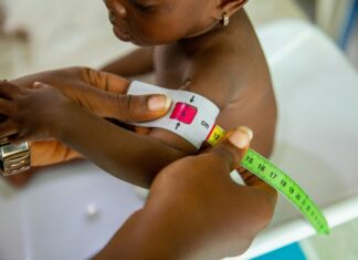 Pulgadas A Cm: ¿Cómo Convertir Fácilmente Con Este Truco Secreto?